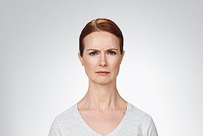 Botox Before & After